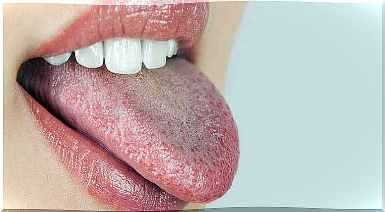 relationship between dry mouth and diabetes