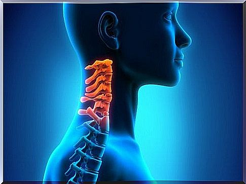 Cervical spondylosis is a form of arthritis.