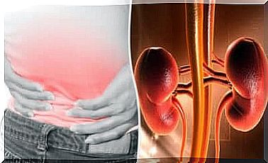 Diagram of kidneys and kidney pain. 