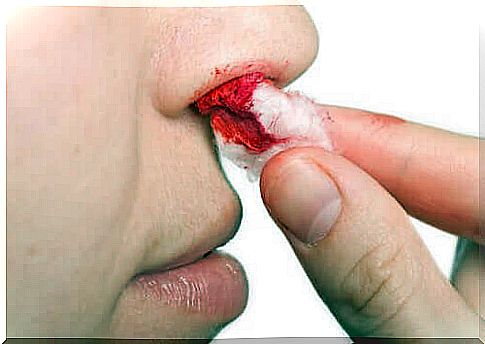 Nose bleeds can be due to various factors