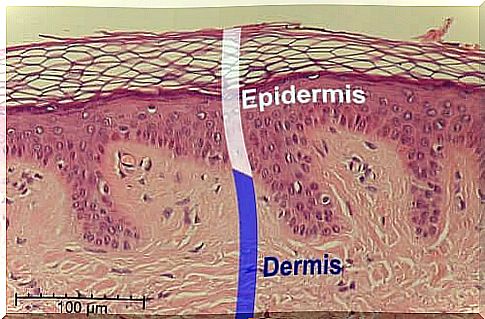 Salicylic acid can have harmful effects on the epidermis